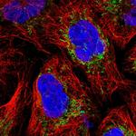 MRPS25 Polyclonal Antibody