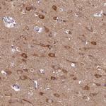 MRPS25 Antibody in Immunohistochemistry (Paraffin) (IHC (P))