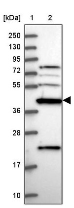 CKMT1A Antibody in Western Blot (WB)