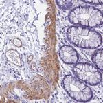 SHFM3 Antibody in Immunohistochemistry (Paraffin) (IHC (P))