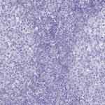 SHFM3 Antibody in Immunohistochemistry (Paraffin) (IHC (P))