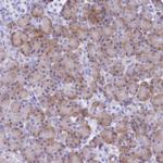 SHFM3 Antibody in Immunohistochemistry (Paraffin) (IHC (P))