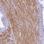 SHFM3 Antibody in Immunohistochemistry (Paraffin) (IHC (P))