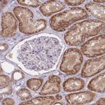 CHAC1 Antibody in Immunohistochemistry (Paraffin) (IHC (P))
