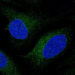 CYP51A1 Polyclonal Antibody