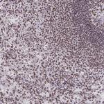 SNRNP70 Antibody in Immunohistochemistry (IHC)