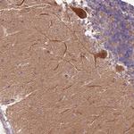 RAPGEF3 Polyclonal Antibody
