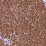 HOOK2 Polyclonal Antibody