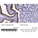 CAPS Antibody in Immunohistochemistry (IHC)