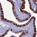 CAPS Antibody in Immunohistochemistry (IHC)