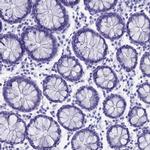 CAPS Antibody in Immunohistochemistry (IHC)