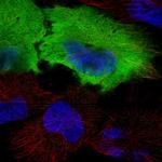 CAPS Polyclonal Antibody