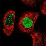 KCTD13 Polyclonal Antibody