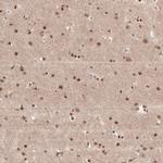 KCTD13 Antibody in Immunohistochemistry (IHC)
