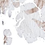 KCTD13 Antibody in Immunohistochemistry (IHC)