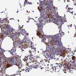 STRN4 Antibody in Immunohistochemistry (Paraffin) (IHC (P))