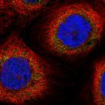 DUS2L Polyclonal Antibody