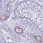 LCMT1 Polyclonal Antibody