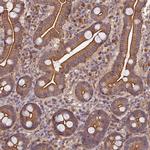 PPP1R12C Antibody in Immunohistochemistry (Paraffin) (IHC (P))