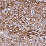 PPP1R12C Antibody in Immunohistochemistry (Paraffin) (IHC (P))