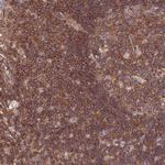 PPP1R12C Polyclonal Antibody