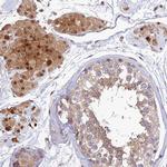 PPP1R12C Antibody in Immunohistochemistry (Paraffin) (IHC (P))