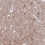 EVA1B Polyclonal Antibody