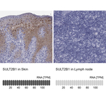 SULT2B1 Antibody in Immunohistochemistry (Paraffin) (IHC (P))