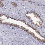 SULT2B1 Antibody in Immunohistochemistry (Paraffin) (IHC (P))