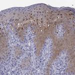 SULT2B1 Antibody in Immunohistochemistry (Paraffin) (IHC (P))