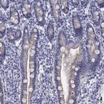 SULT2B1 Antibody in Immunohistochemistry (Paraffin) (IHC (P))
