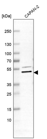 SULT2B1 Antibody in Western Blot (WB)