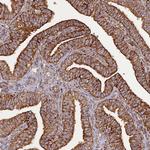 DYM Antibody in Immunohistochemistry (Paraffin) (IHC (P))
