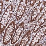 CIB3 Polyclonal Antibody