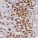 DHX34 Polyclonal Antibody
