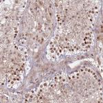 ERICH6B Polyclonal Antibody