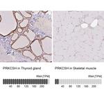 PRKCSH Polyclonal Antibody