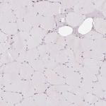 PRKCSH Antibody in Immunohistochemistry (IHC)