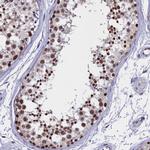 CCDC97 Antibody in Immunohistochemistry (Paraffin) (IHC (P))