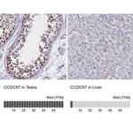CCDC97 Antibody in Immunohistochemistry (IHC)