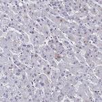 CCDC97 Antibody in Immunohistochemistry (IHC)