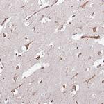 KRI1 Antibody in Immunohistochemistry (Paraffin) (IHC (P))