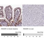 RAVER1 Antibody in Immunohistochemistry (IHC)