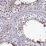 RAVER1 Antibody in Immunohistochemistry (IHC)