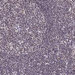 RAVER1 Antibody in Immunohistochemistry (IHC)