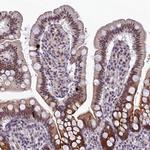 RAVER1 Antibody in Immunohistochemistry (IHC)