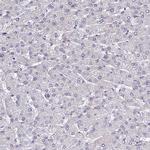 RAVER1 Antibody in Immunohistochemistry (IHC)