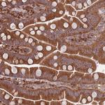 COPE Antibody in Immunohistochemistry (Paraffin) (IHC (P))