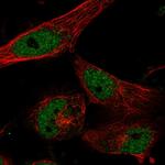 CLCN7 Antibody in Immunocytochemistry (ICC/IF)