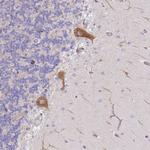 AADACL4 Polyclonal Antibody